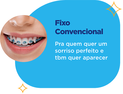 Aparelho fixo convencional